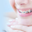 kids-braces-in-woden-1